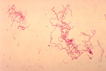 HAEMOPHILUS DUCREYI.jpg