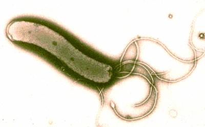 HELICOBACTER PYLORI.gif