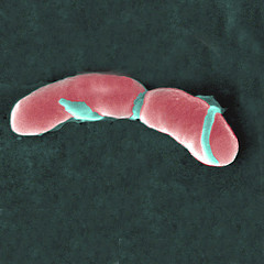 LISTERIA MONOCYTOGENES.jpg