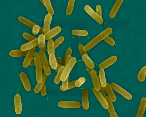 PSEUDOMONAS AERUGINOSA 2.jpg