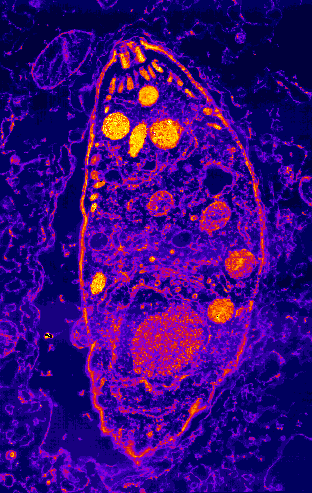 TOXOPLASMA GONDII.gif