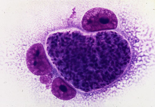 TOXOPLASMA GONDII 2.jpg