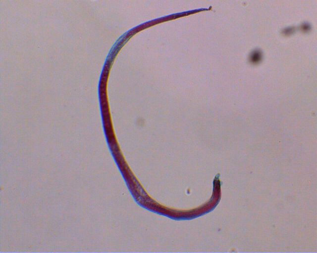 TRICHINELLA SPIRALIS.jpg