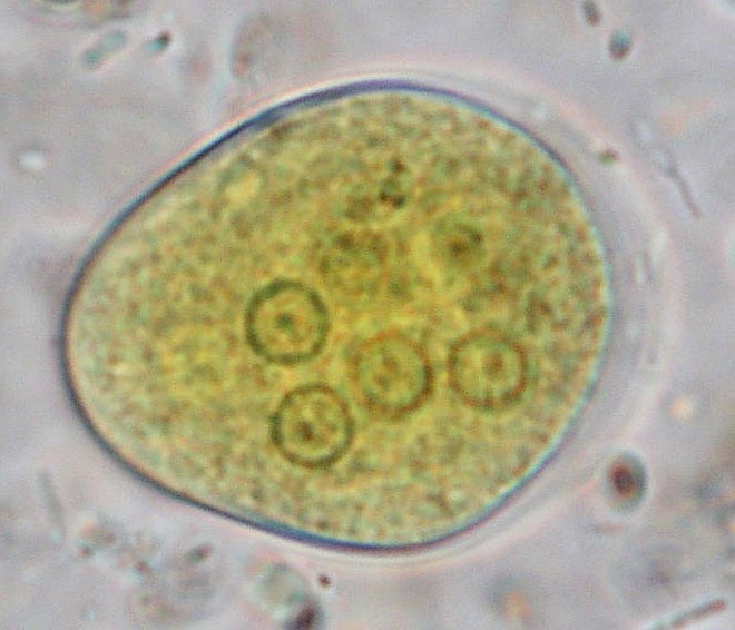 ANTAMOEBA COLI.jpg