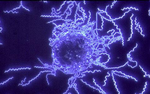 BORRELIA BURGDORFERI.jpe