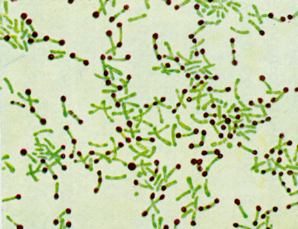 CORYNEBACTERIUM DIPHTHERIAE.jpg