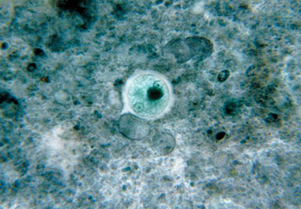 ENTAMOEBA HISTOLYTICA.jpg