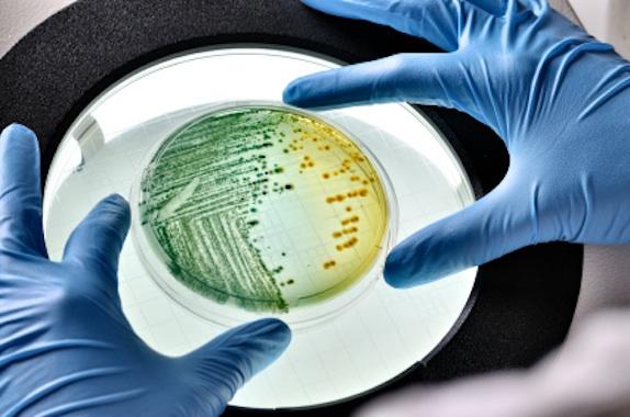 global_biologicalengineering-microorganism-petri-dish-istk.jpg