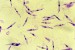 LEISHMANIA TROPICA 2.jpg