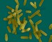 PSEUDOMONAS AERUGINOSA 2.jpg